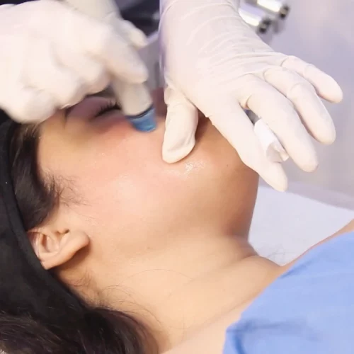 Spezial-Behandlng(4)